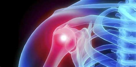 остра болка в раменната става при повдигане на лечение с ръка